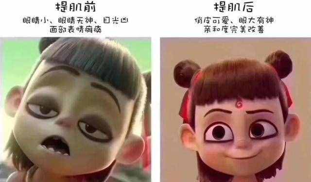 为什么从小就有抬头纹，眼睛还比别人小？