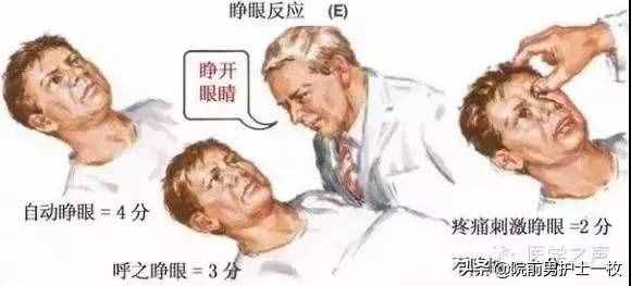 意识障碍病人的评估