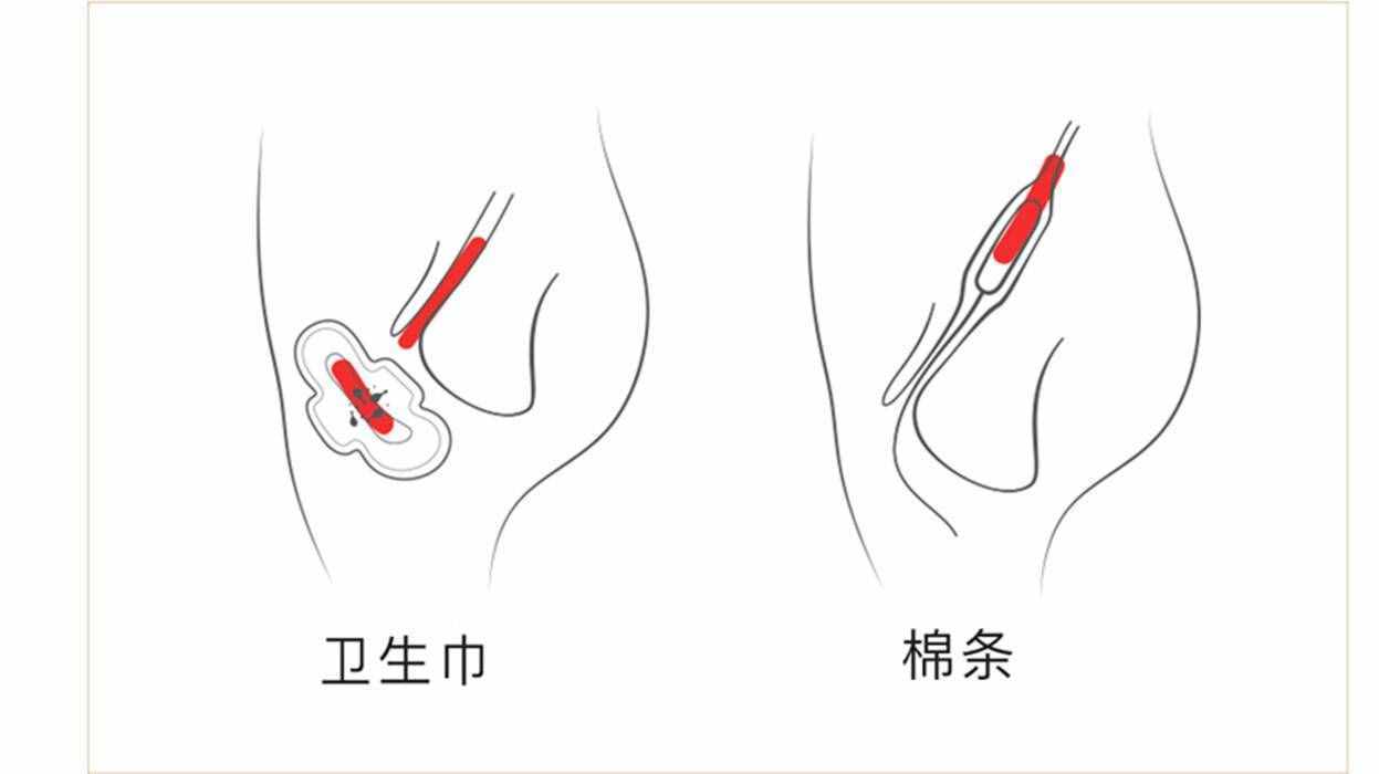 卫生棉条的正确使用方法