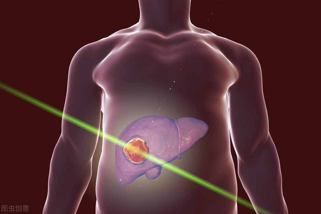 肝癌死亡率极高，肝癌初期有哪些症状