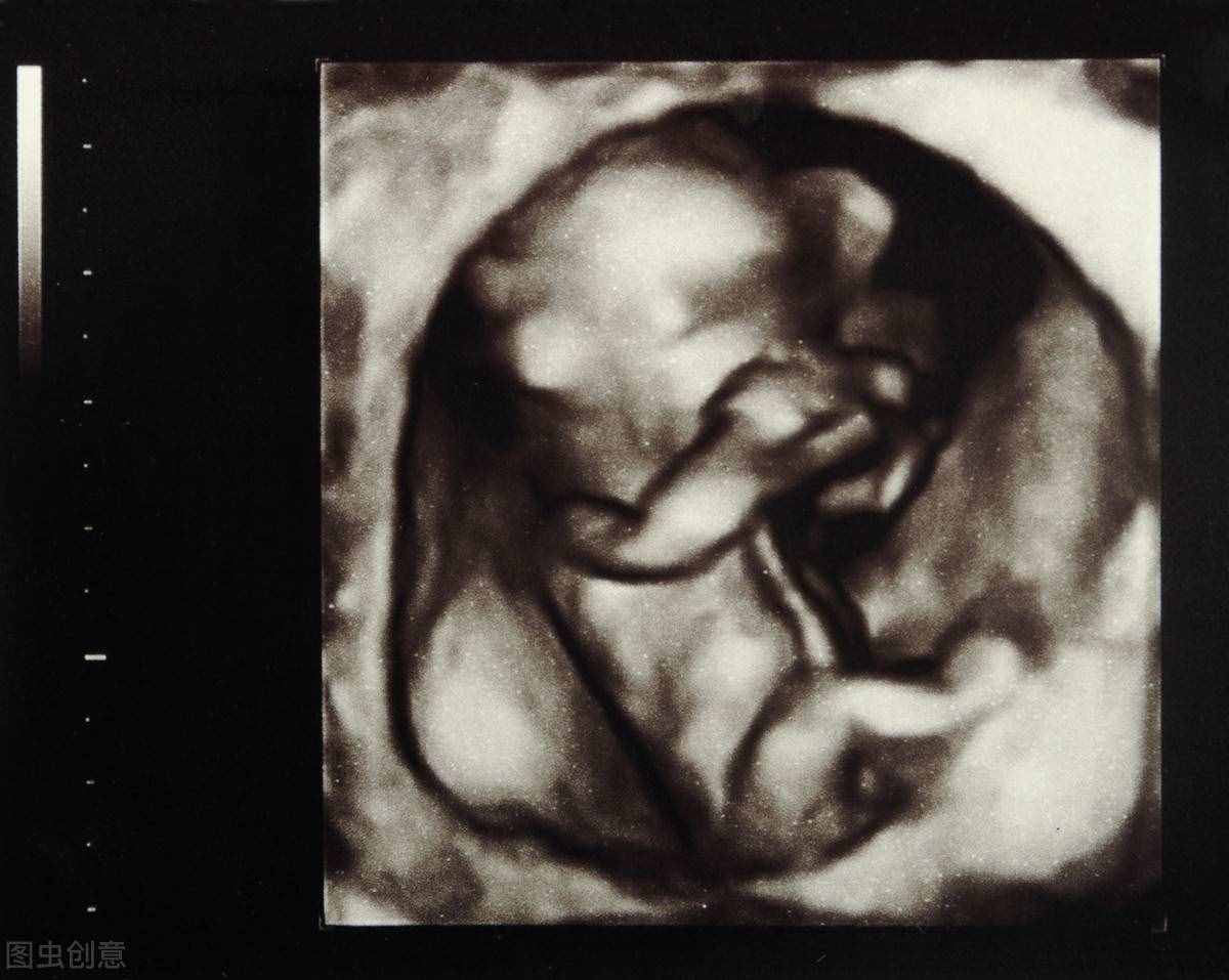 胎儿四维照为何丑哭？“头大腿短”暗示什么？孕期四维必备知识点